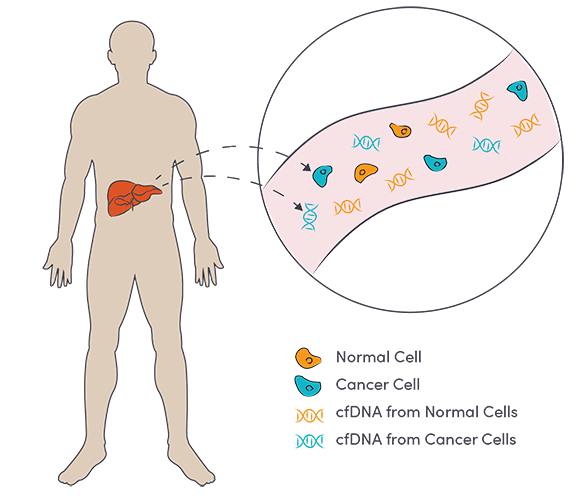 Image of Cell-free DNA Methylation